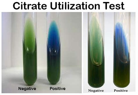 Citrate Test .
